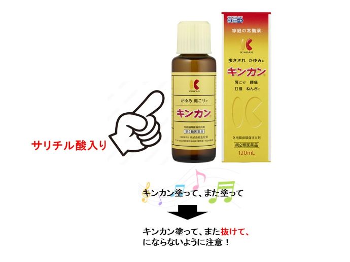 円形脱毛症　病院